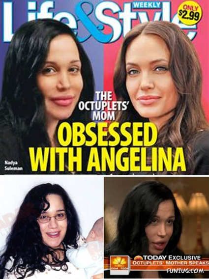 Most Amazing Plastic Surgeries